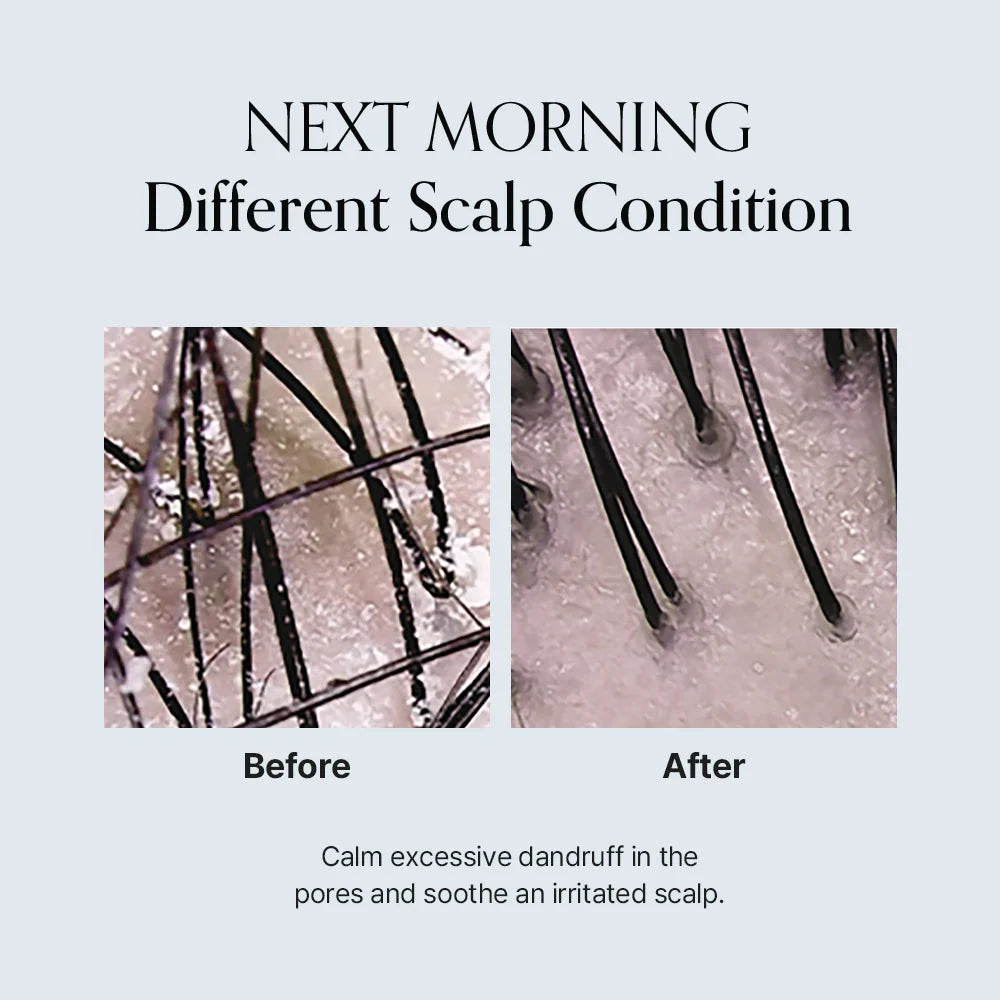 Damage Therapy Scalp Scaling Ampoule