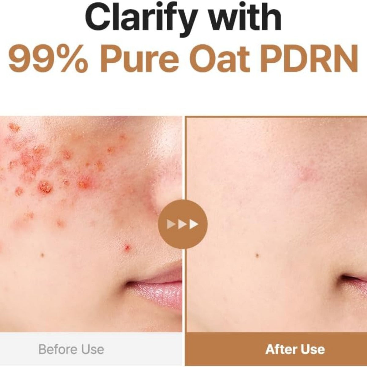Oat PDRN Gentle Refining Toner