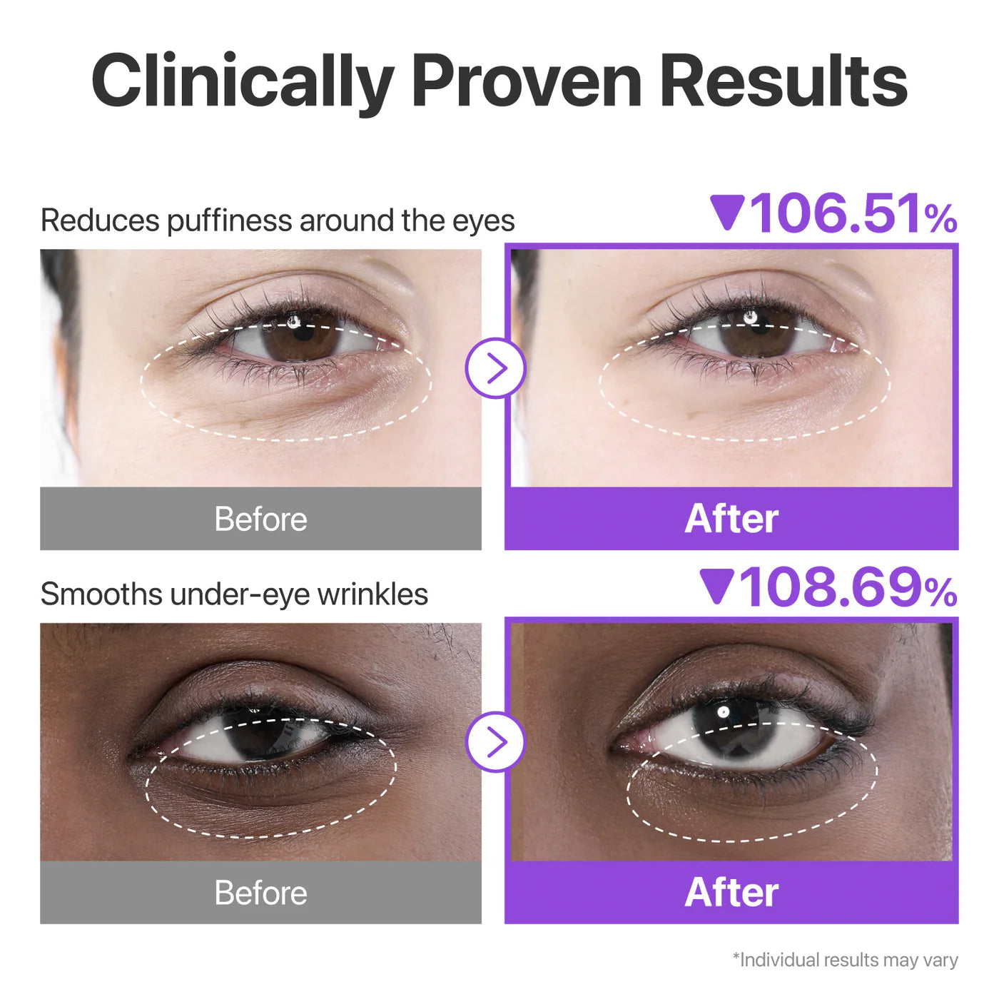 NAD+ Collagen Under Eye Patches