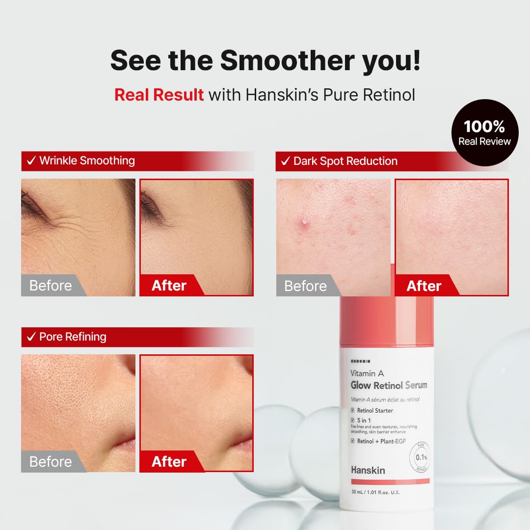 Vitamin A Glow Retinol Serum