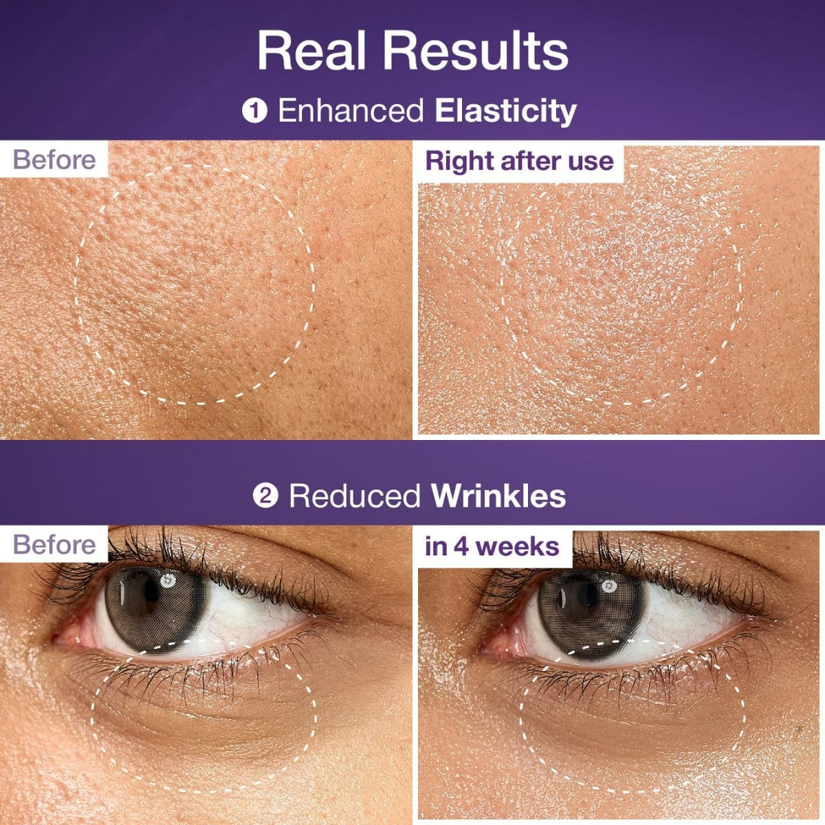 No.9 NAD Bio Lifting-sil Essence