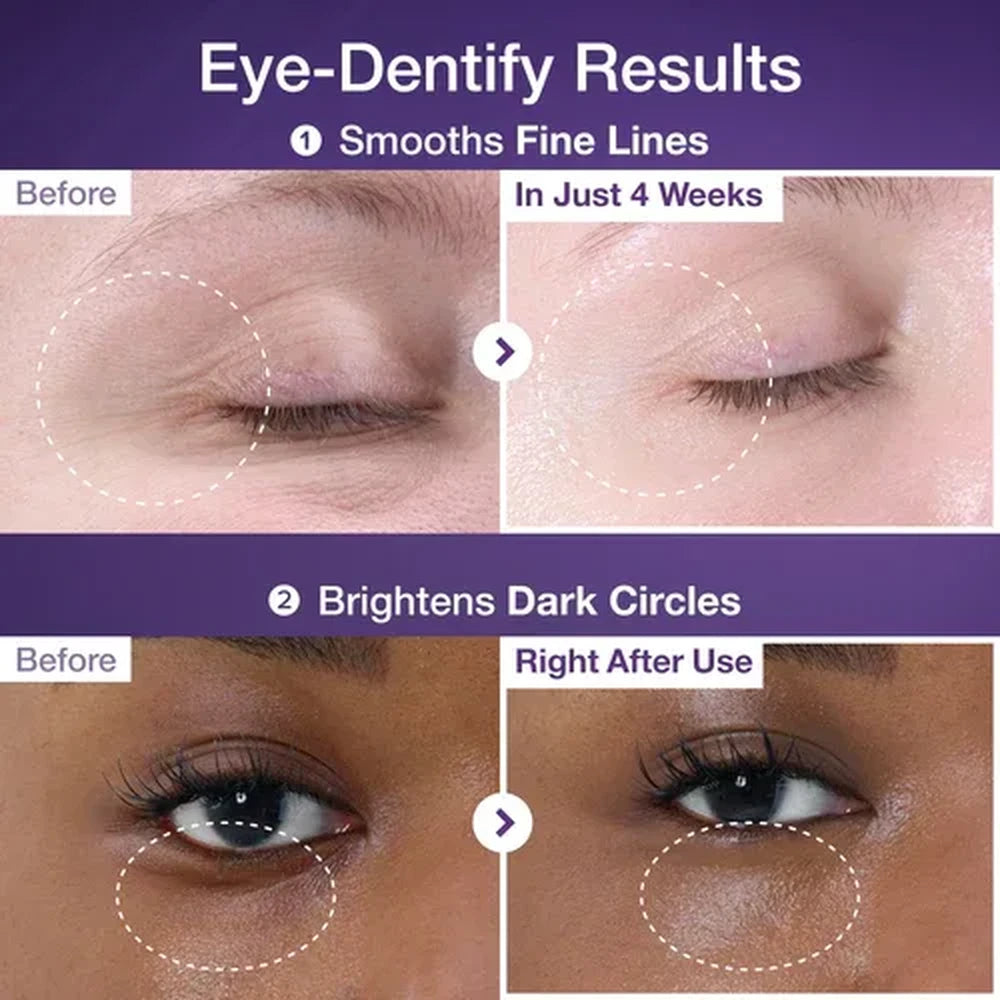 NAD+ Retinol Volumetox Eye Cream