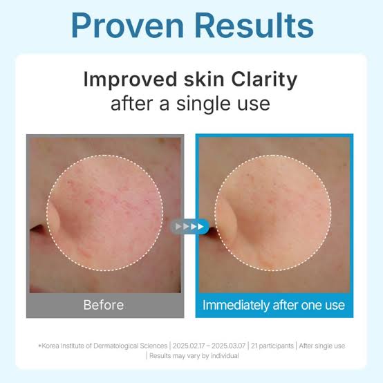 Hyal Waterfull Glow Gel Mask