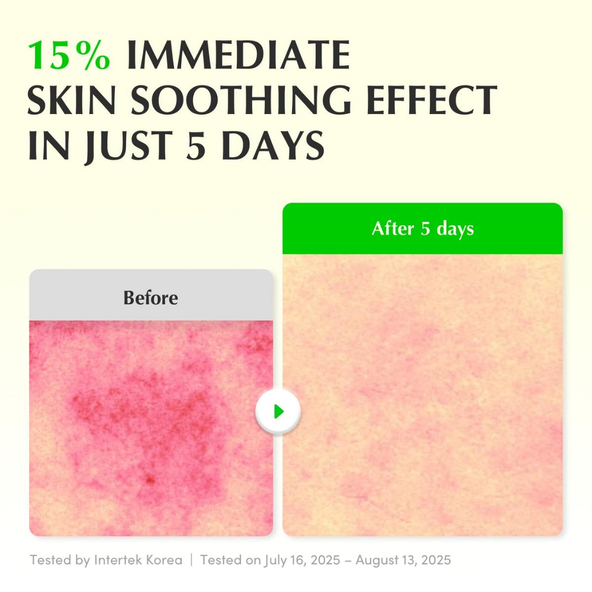 Aloe PDRN Calming Serum