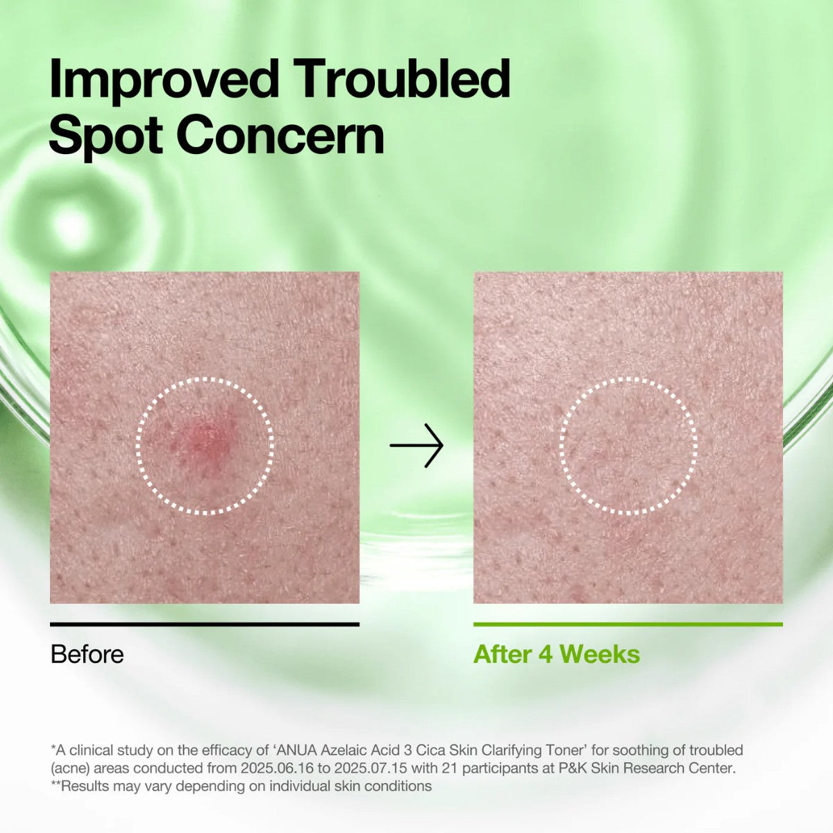 Azelaic Acid 3 Cica Skin Clarifying Toner