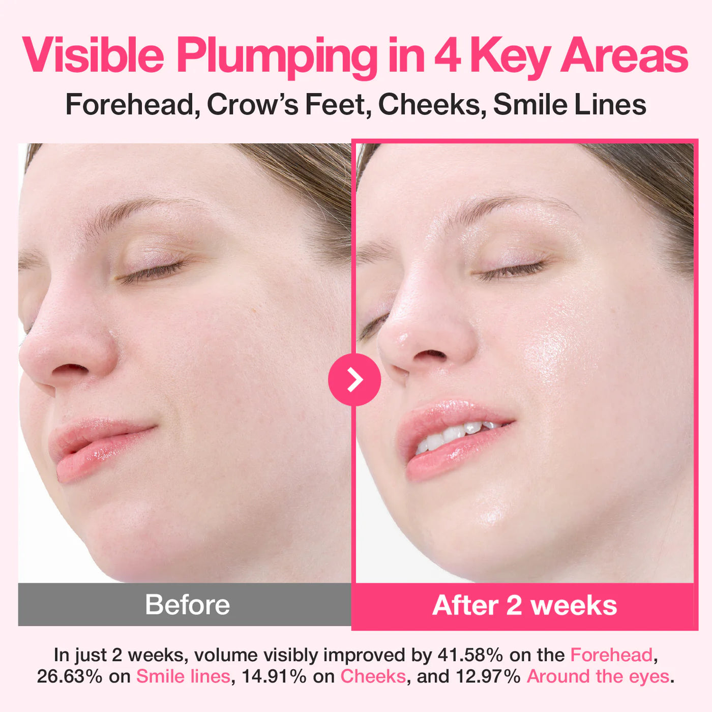 Rose PDRN Collagen Plumping Serum