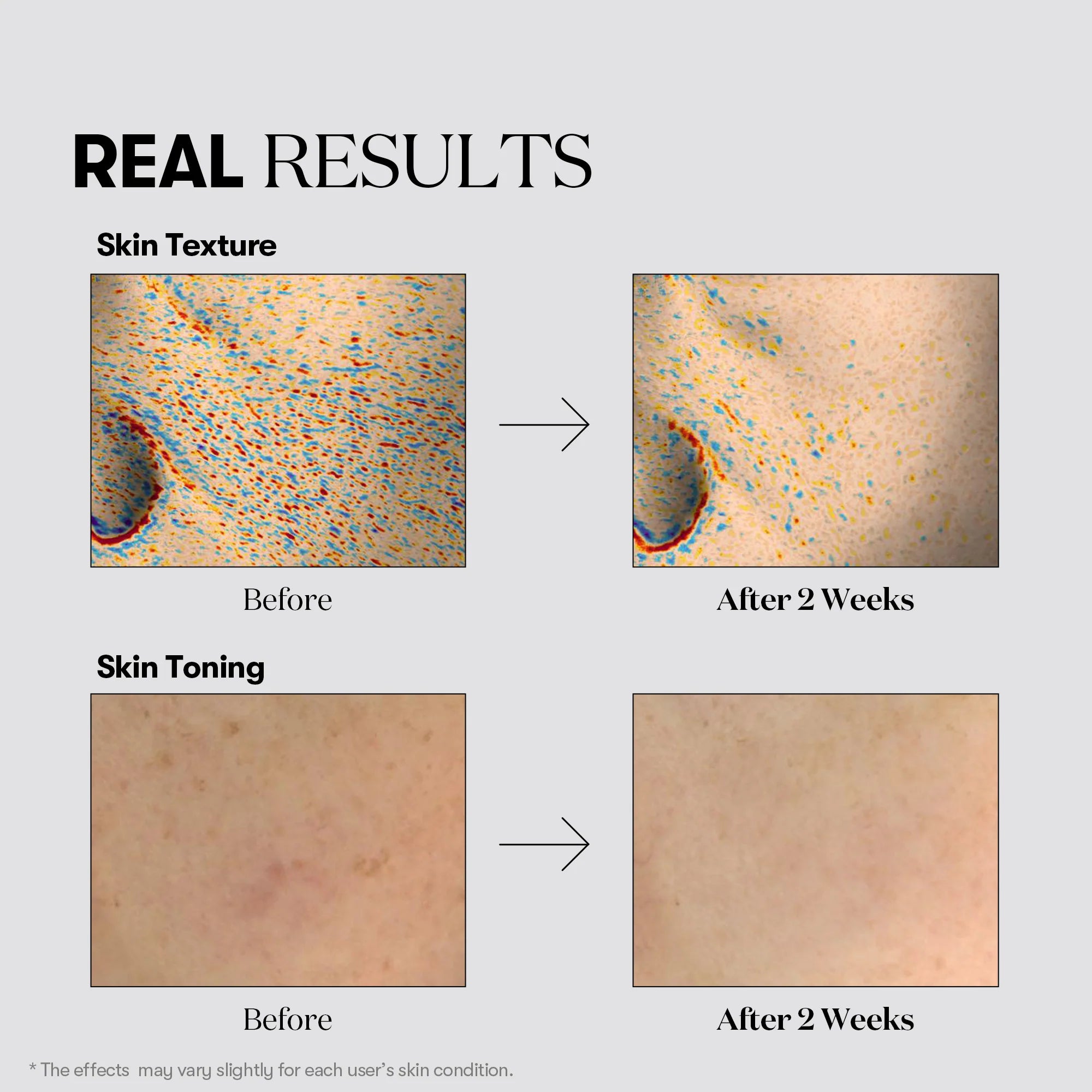 TX-Toning Toner Radiance & Skin Balancing
