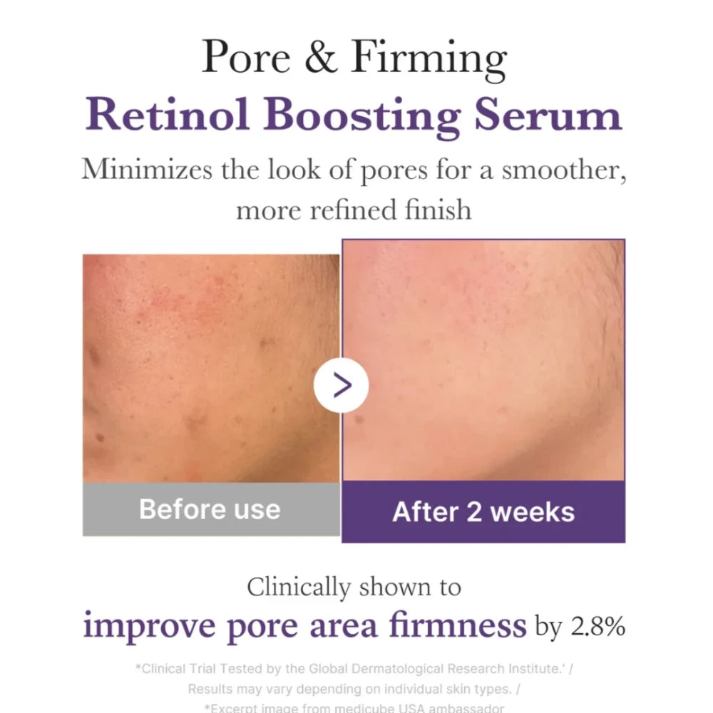 Retinol Boosting Serum