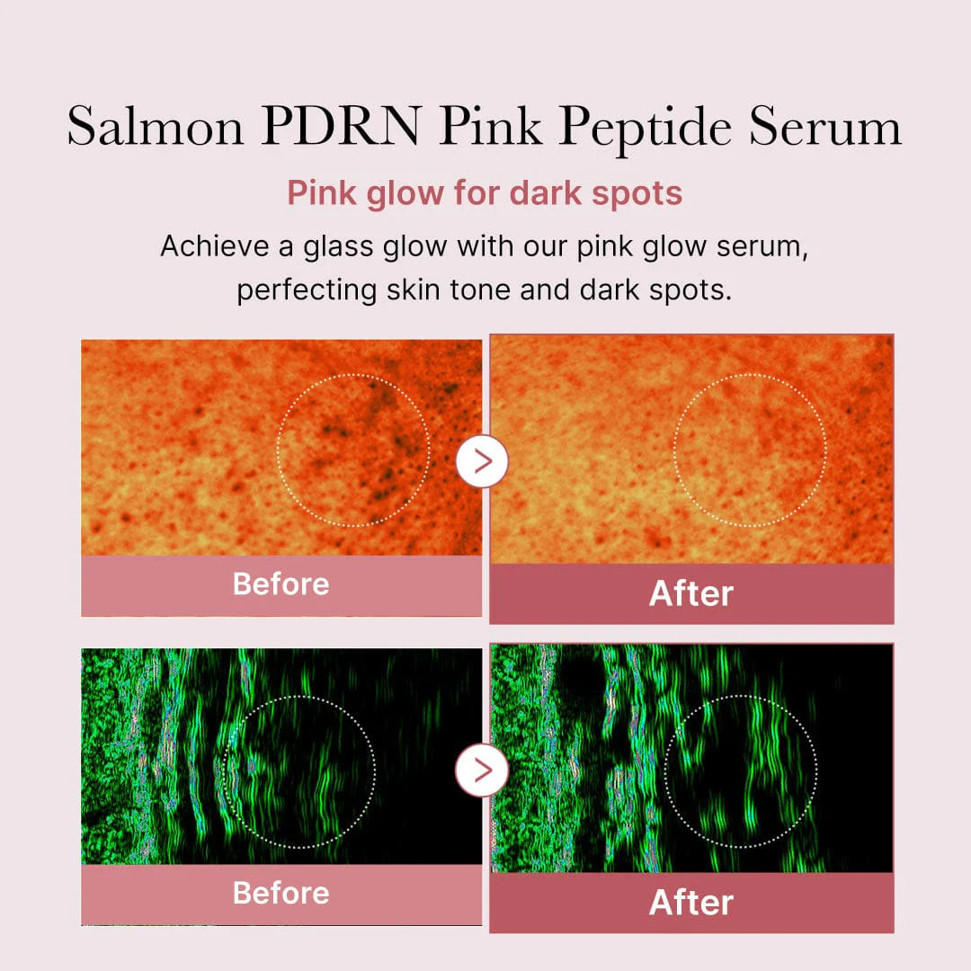 PDRN Pink Peptide Serum